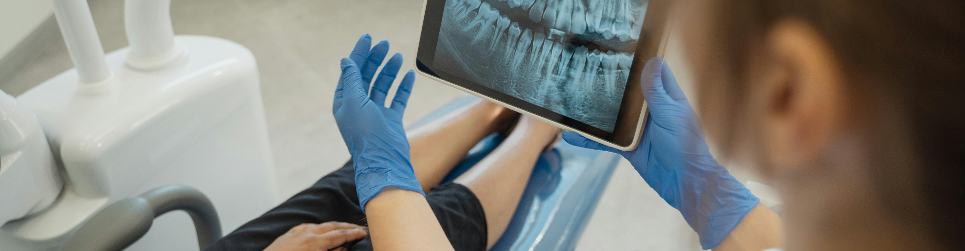 Gloved hands holding a dental X-ray.